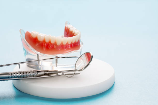 Full Mouth Reconstruction in Holgate, OH